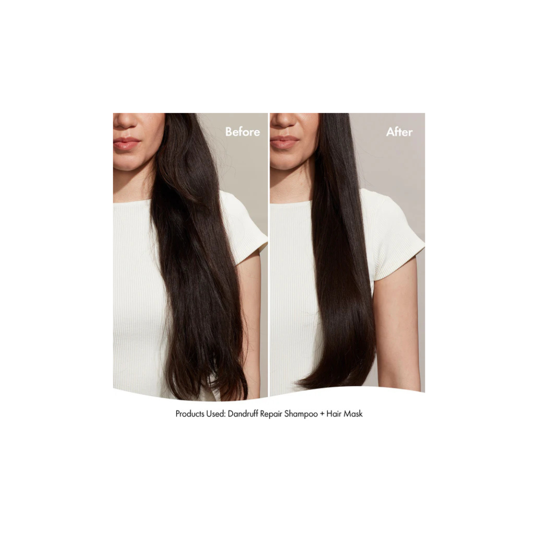 BONDI BOOST DANDRUFF REPAIR HAIR MASK 250ML