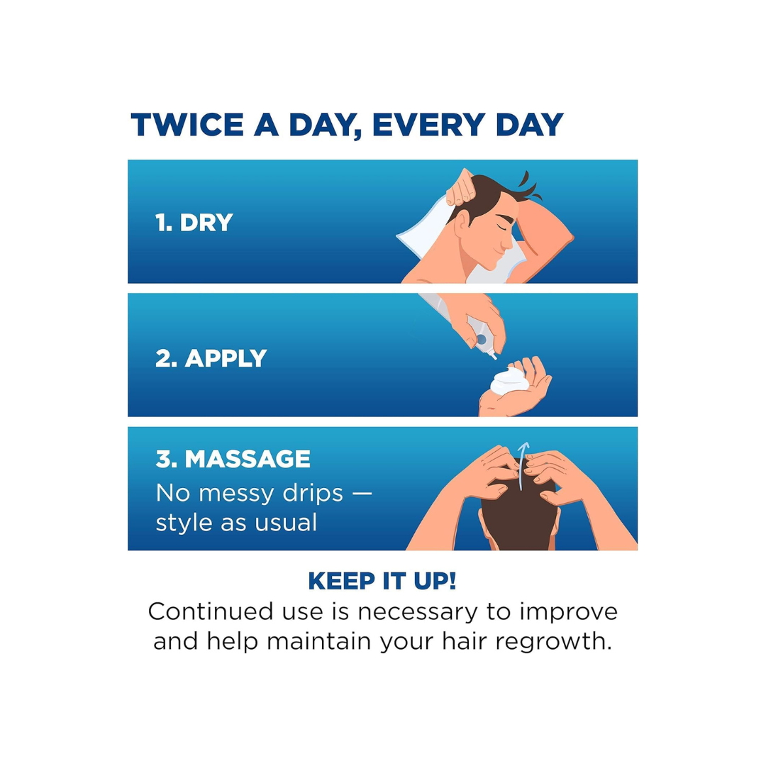 Rogaine Men’s Hair Loss & Thinning Treatment for Hair Regrowth, 5 Minoxidil Foam Extra Strength,3X60G